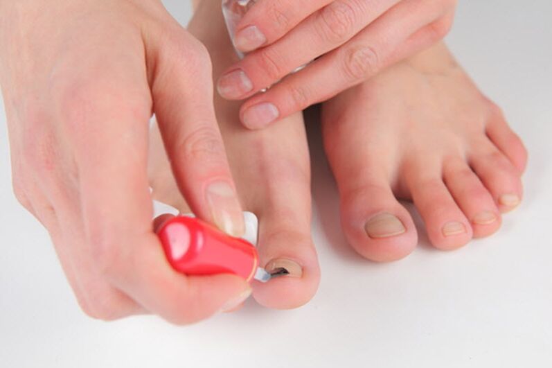 Prevention of fungi standing