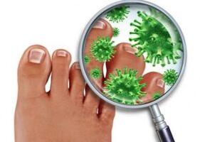 Methods of treating toenail fungus