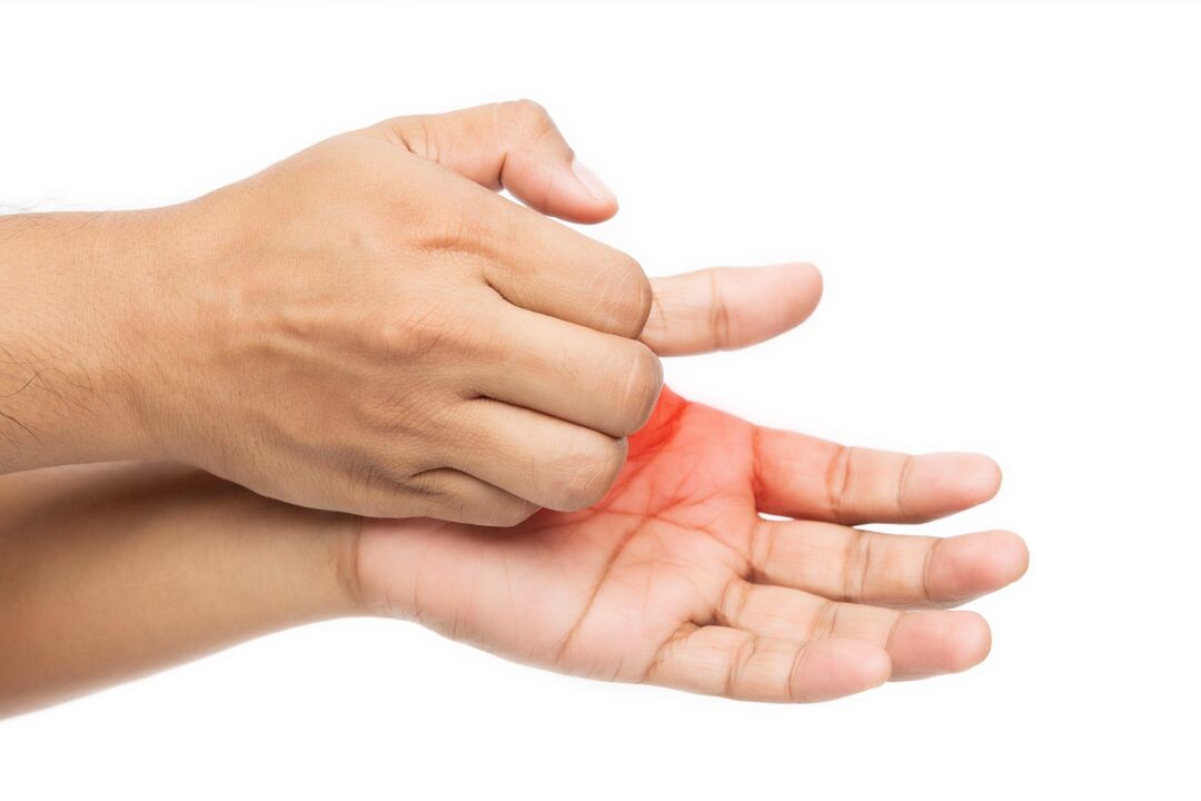 itching with a fungus and its treatment with zxcvbnqwert cream with cream